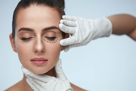 Blefaroplastia