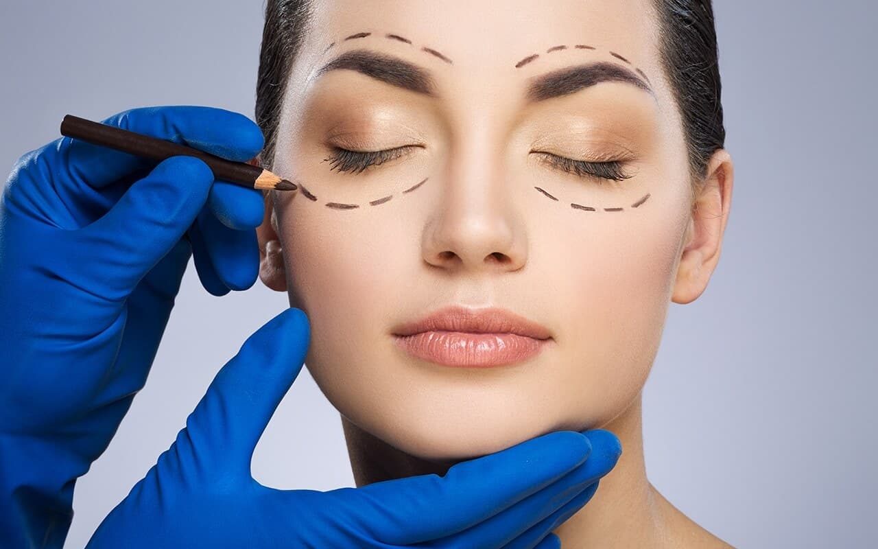 Blefaroplastia