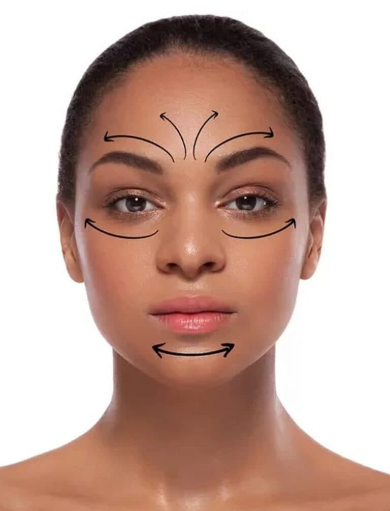 Puntos de Aplicación Botox